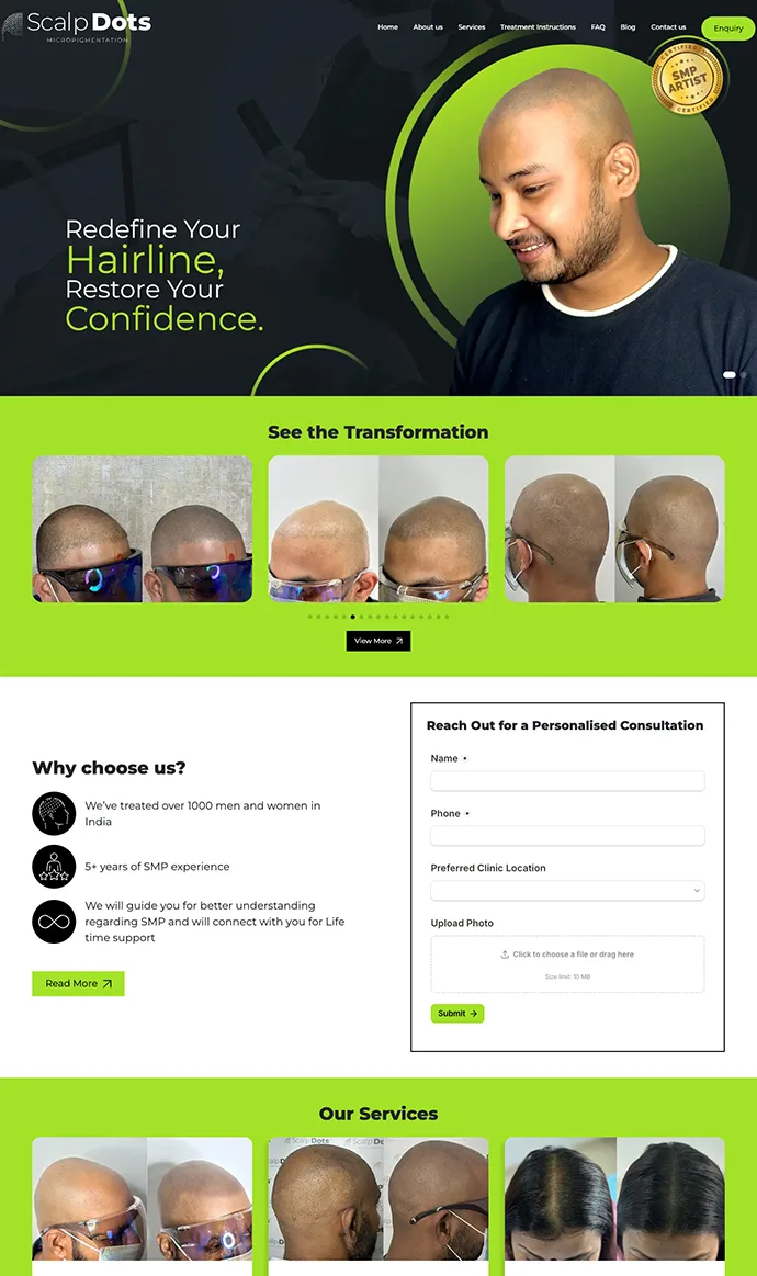 Scalp Dots website design featuring scalp micropigmentation services, hairline restoration, and before-and-after results